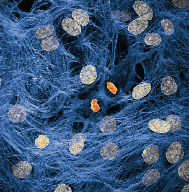 сердечная мышца